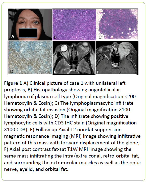 archives-inflammation-Clinical-picture