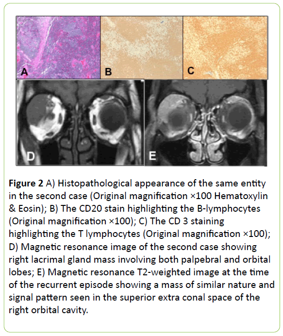 archives-inflammation-Histopathological-appearance